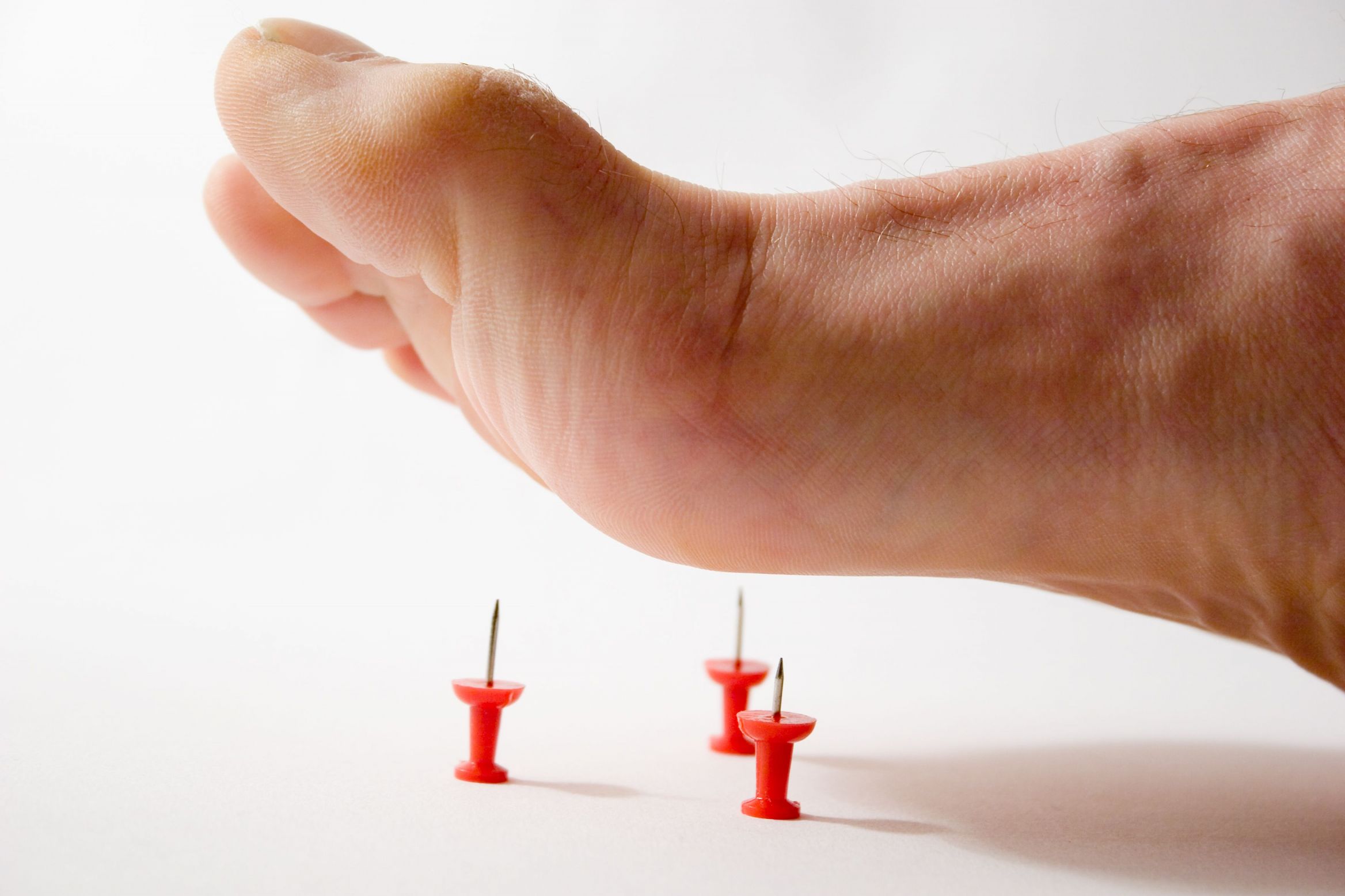 loss of sensation neuropathy diabetic foot brisbane podiatry